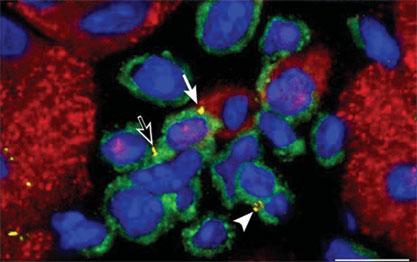 Heart may be home to its own stem cells | New Scientist