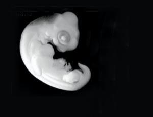 Embryo origami gives the turtle its shell | New Scientist