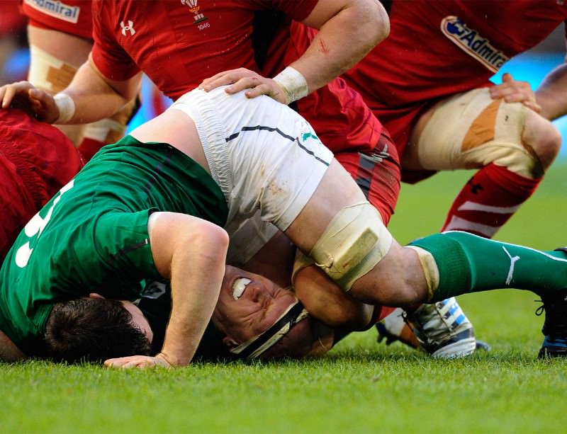 Rugby players warned of long-term brain injury risks | New Scientist