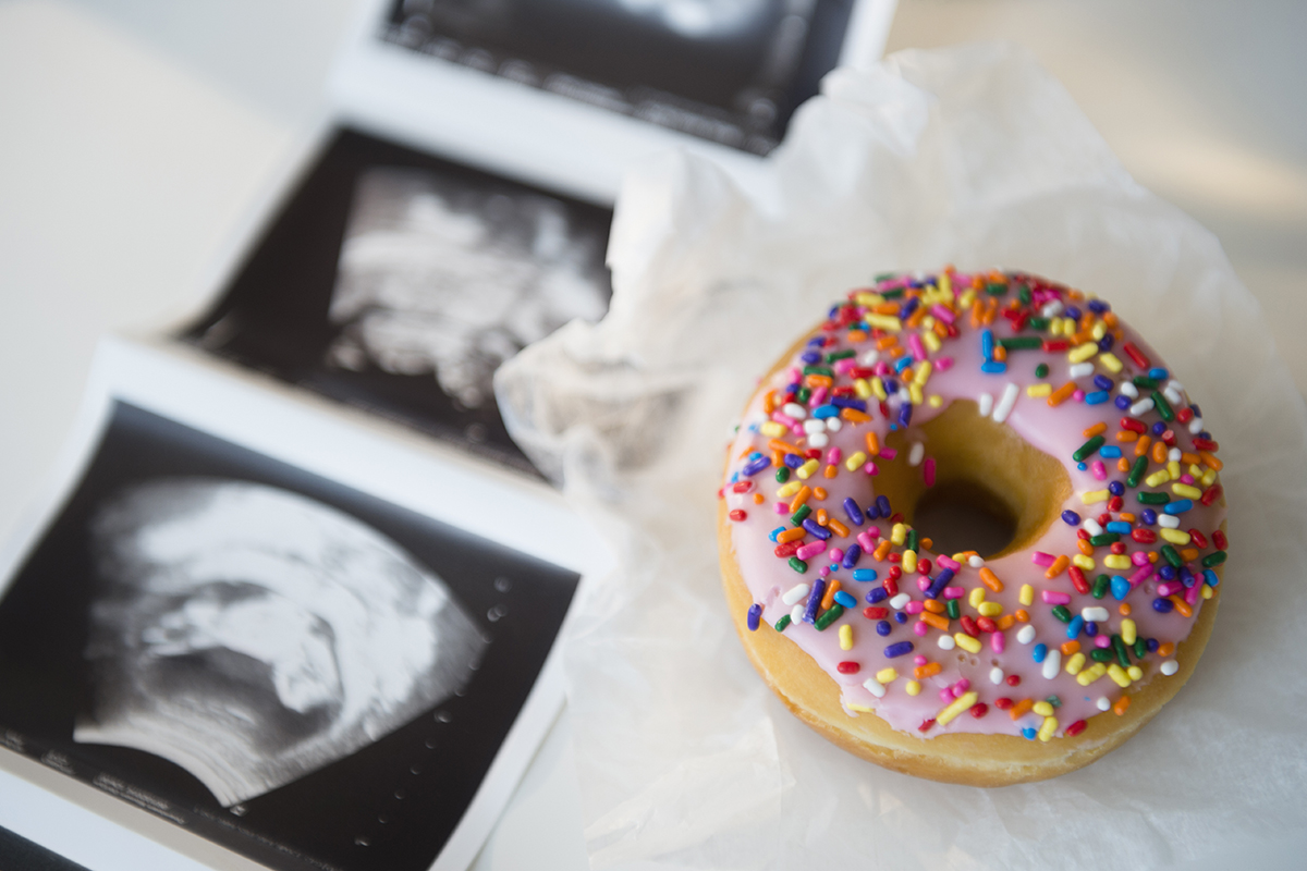 High sugar intake in pregnancy may increase allergies risk in children High sugar intake in pregnancy may increase allergies risk in children