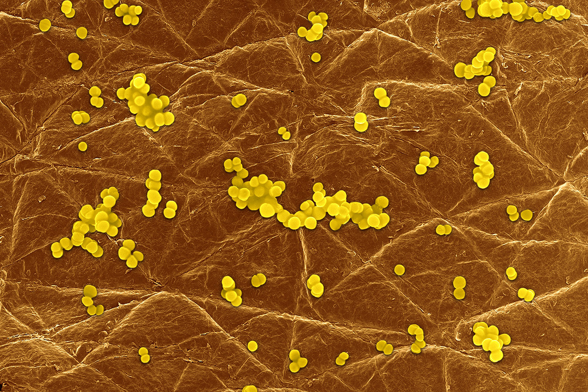 Pictures Of The Bacteria Staphylococcus Aureus 97