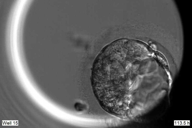 Editing Embryo DNA Yields Clues About Early Human Development