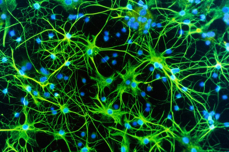 Neurons in the brain