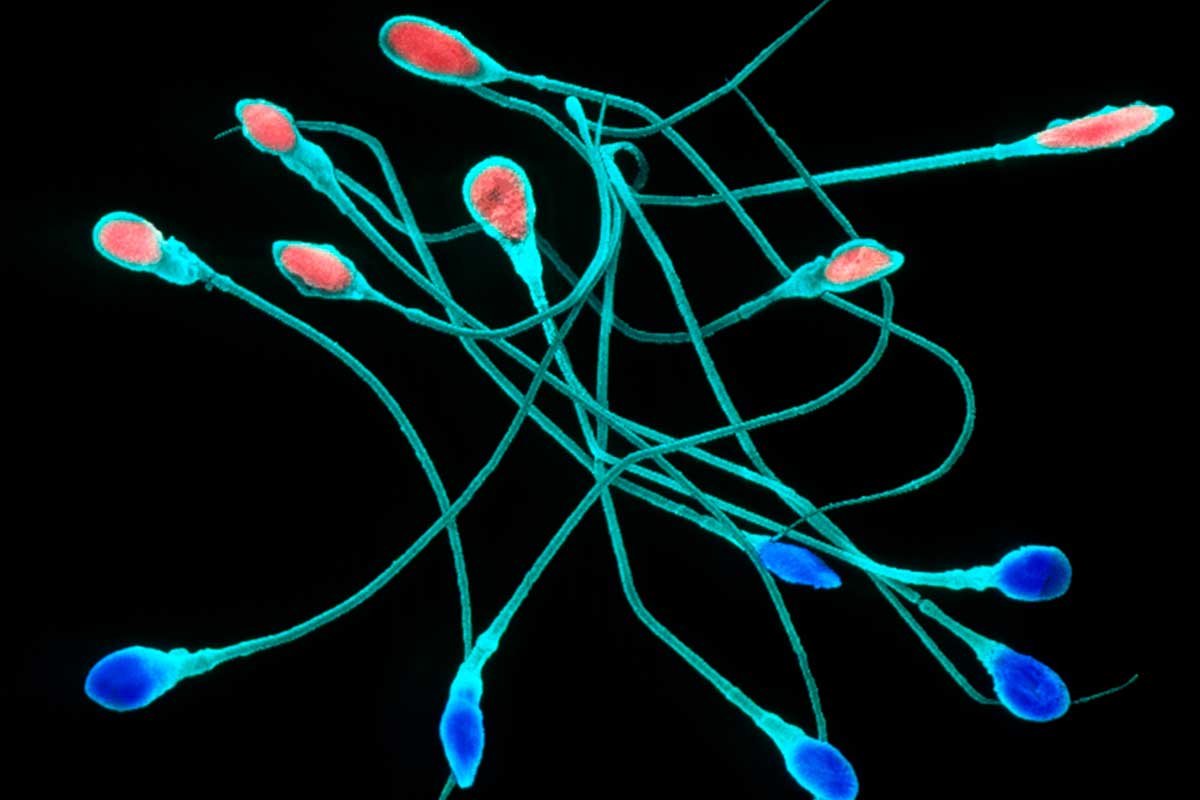 Sperm dna in humans Sperm dna in humans